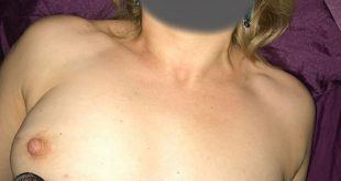 Photo de ma poitrine